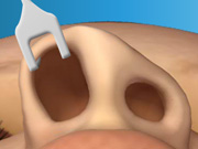 Virtual Nose Job Surgery